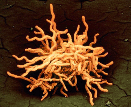 Image: Colored scanning electron micrograph (SEM) of a conglomeration of Borrelia burgdorferi bacteria, cause of Lyme disease in humans (photo courtesy Juergen Berger / Science Photo Library).